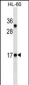 CALCA/CT Antibody(Ascites)